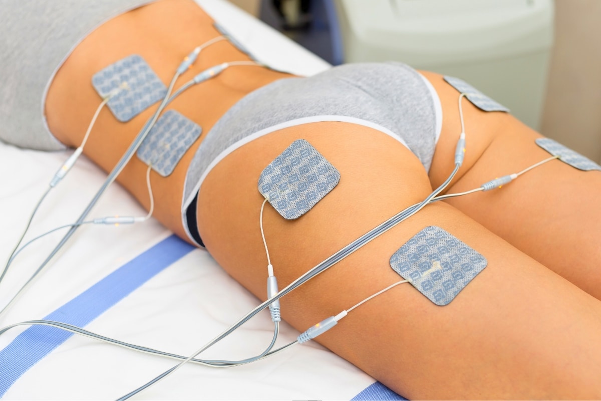 electrostimulation Electrostimulation